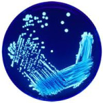 What is Legionella and How Do I Test for It?
